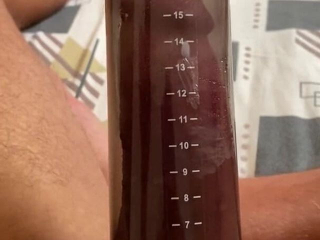 My Erect Penis Was 12 Cm Before Using the Penis Pump and After Using It It Was 19 Cm (Greedy truck)